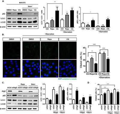 The Autophagy Regulator p62 Controls PTEN-Dependent Ciliogenesis